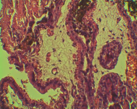Незрелая ворсина с периферическим расположением плодовых капилляров (увел.10 × 40)